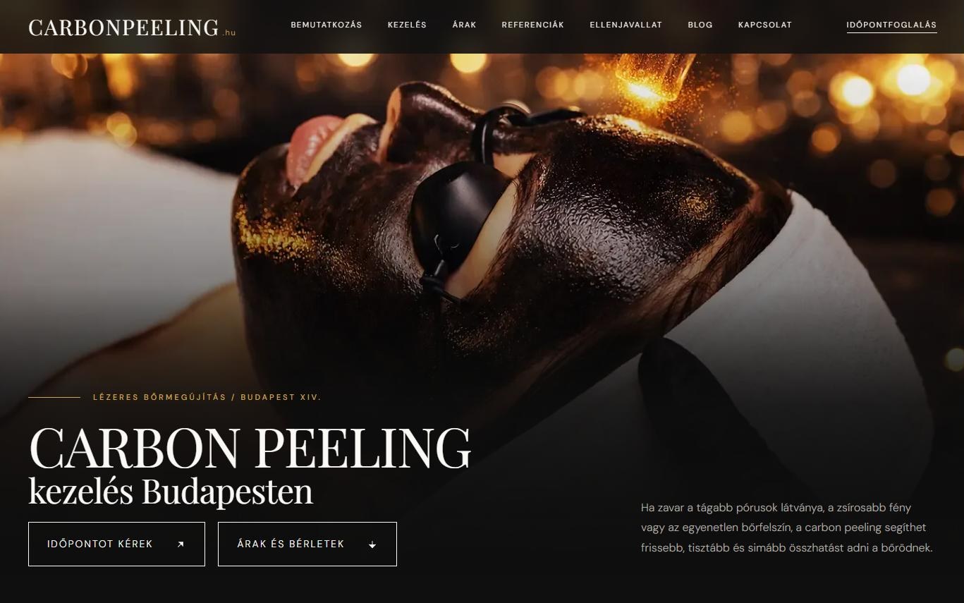 A carbonpeeling.hu weboldal nyitóképe
